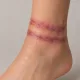 Bondage Marks — Cuff Marks