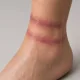 Bondage Marks — Rope Marks