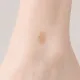 Freckles, Moles & Birthmarks — Soft