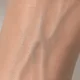Veins & Natural Skin Colouring — Light